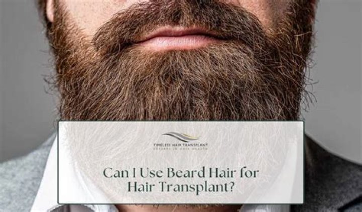 Can I use beard hair for hair transplant?