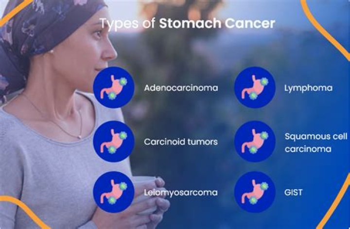 Can stomach cancer be treated without surgery?
