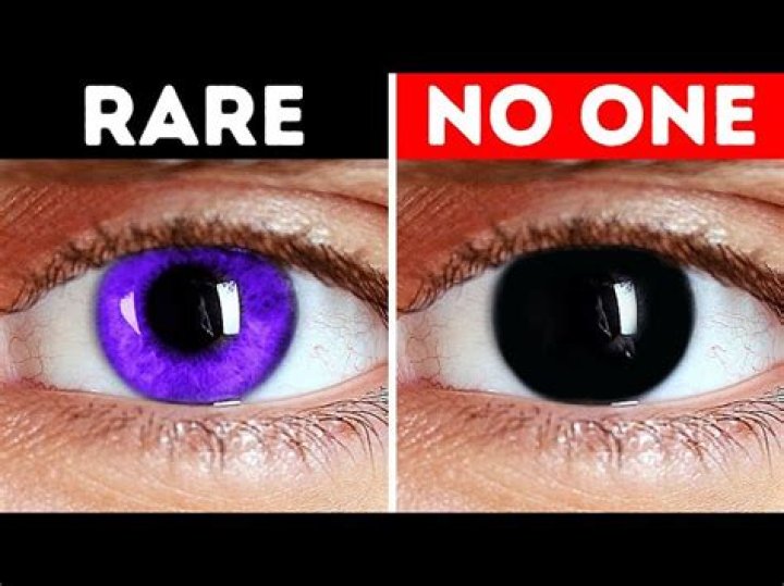 Can you really have violet eyes?