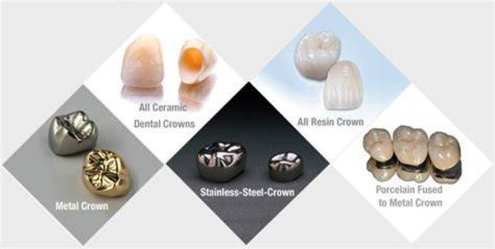 What are metal dental caps made of?