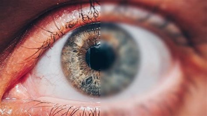 What does it mean when your eyes lose focus?