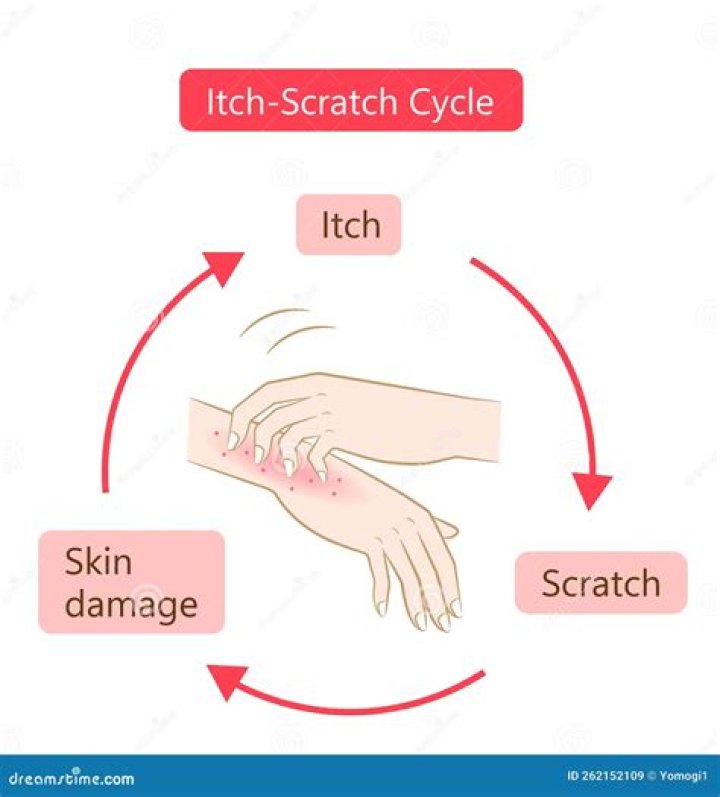 Why you shouldn't scratch an itch?